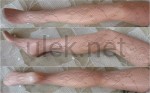 Veneziana Tights Pizzo Sissi
